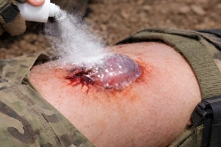 توقف یک ثانیه‌ای خونریزی ممکن شد