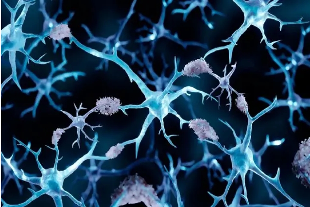 چرا مبتلایان به سرطان از آلزایمر مصون‌اند؟