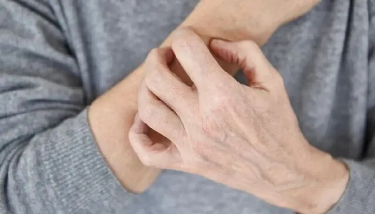 پوست شما چه بیماری‌هایی را لو می‌دهد